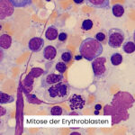 Abbildung Mitose der Erythroblasten