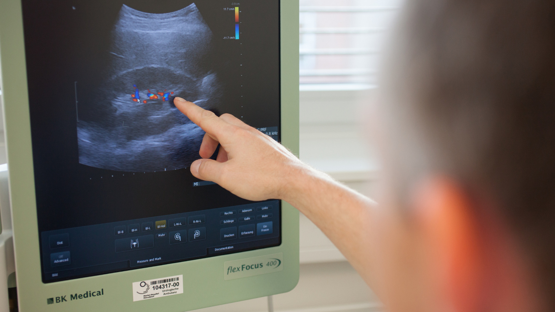 Arzt zeigt auf Ultraschallbild